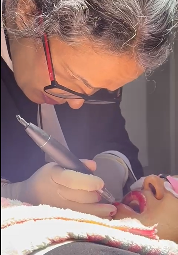 Lower face injection training